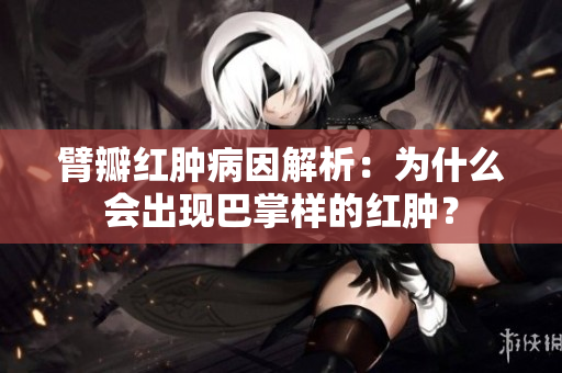 臂瓣紅腫病因解析：為什么會(huì)出現(xiàn)巴掌樣的紅腫？